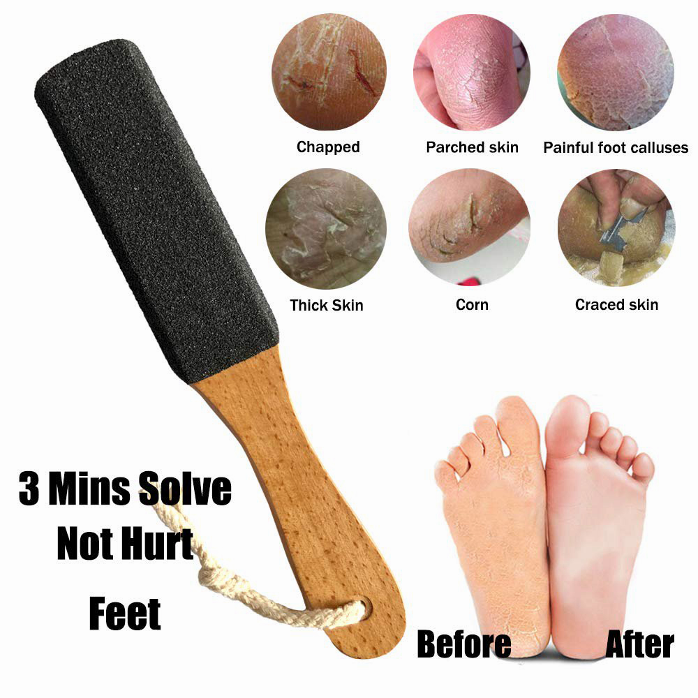 Callus Remover